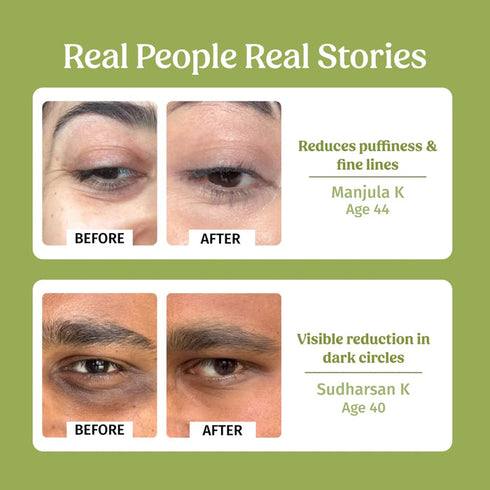 Vilvah Store Under Eye Cream |Dark Circles Control